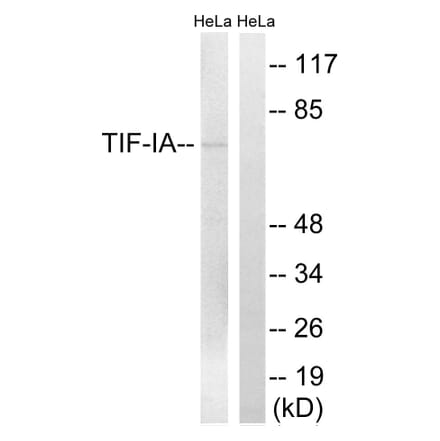 Western Blot - Anti-TIF-IA Antibody (B8433) - Antibodies.com