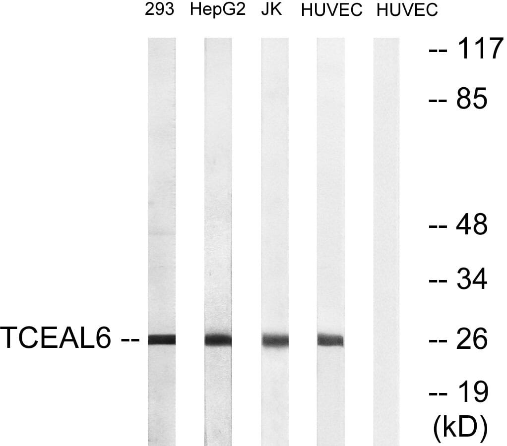 Western blot analysis of lysates from HUVEC, 293, HepG and Jurkat cells using Anti-TCEAL6 Antibody. The right hand lane represents a negative control, where the antibody is blocked by the immunising peptide.
