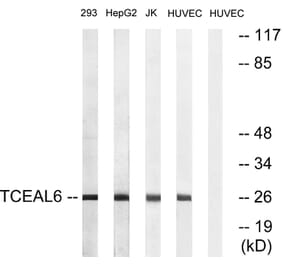 Western Blot - Anti-TCEAL6 Antibody (C19164) - Antibodies.com