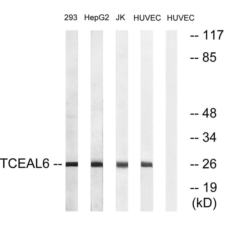 Western Blot - Anti-TCEAL6 Antibody (C19164) - Antibodies.com