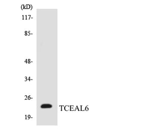 Western Blot - Anti-TCEAL6 Antibody (R12-3608) - Antibodies.com