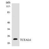 Western Blot - Anti-TCEAL6 Antibody (R12-3608) - Antibodies.com