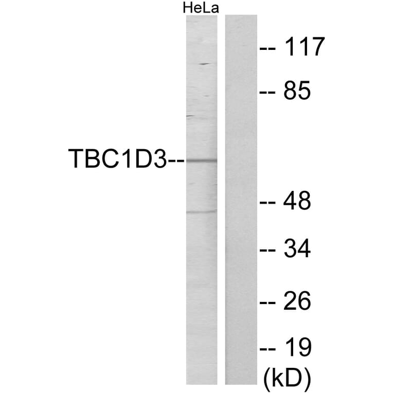 Western Blot - Anti-TBC1D3 Antibody (C11330) - Antibodies.com