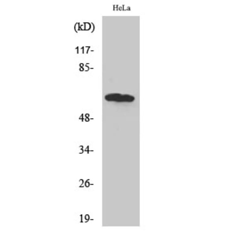 Western Blot - Anti-TBC1D3 Antibody (C11330) - Antibodies.com