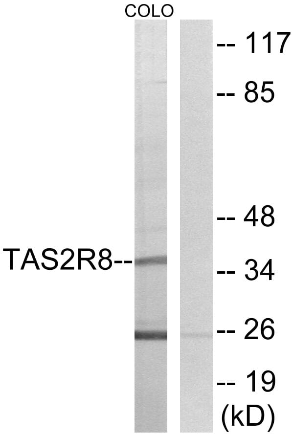 Western blot analysis of lysates from COLO cells using Anti-TAS2R8 Antibody. The right hand lane represents a negative control, where the antibody is blocked by the immunising peptide.