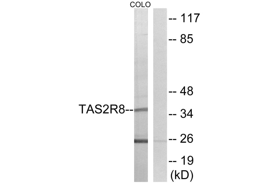 Western Blot - Anti-TAS2R8 Antibody (G768) - Antibodies.com