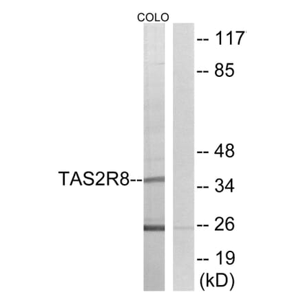 Western Blot - Anti-TAS2R8 Antibody (G768) - Antibodies.com