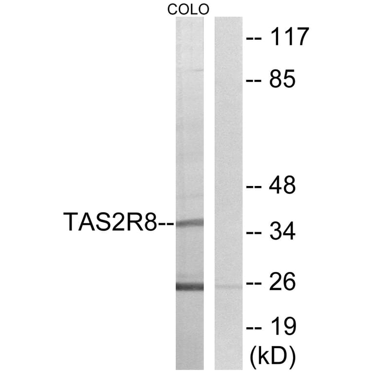 Western Blot - Anti-TAS2R8 Antibody (G768) - Antibodies.com