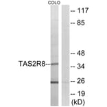 Western Blot - Anti-TAS2R8 Antibody (G768) - Antibodies.com