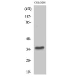 Western Blot - Anti-TAS2R8 Antibody (G768) - Antibodies.com
