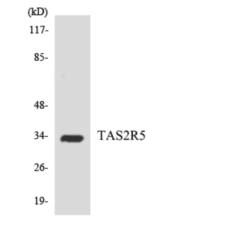 Western Blot - Anti-TAS2R5 Antibody (R12-3596) - Antibodies.com