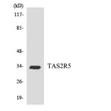 Western Blot - Anti-TAS2R5 Antibody (R12-3596) - Antibodies.com