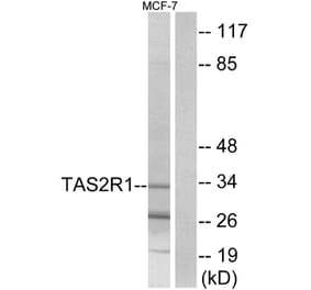 Western Blot - Anti-TAS2R1 Antibody (G763) - Antibodies.com