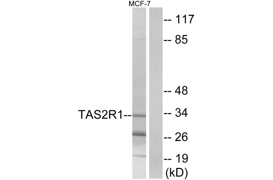 Western Blot - Anti-TAS2R1 Antibody (G763) - Antibodies.com