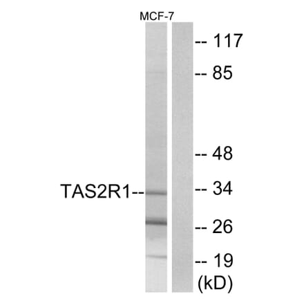 Western Blot - Anti-TAS2R1 Antibody (G763) - Antibodies.com