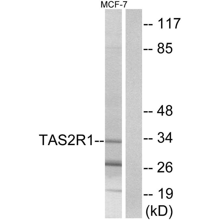 Western Blot - Anti-TAS2R1 Antibody (G763) - Antibodies.com