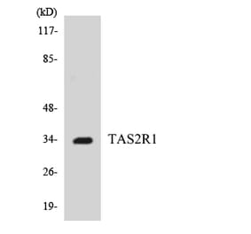 Western Blot - Anti-TAS2R1 Antibody (R12-3588) - Antibodies.com