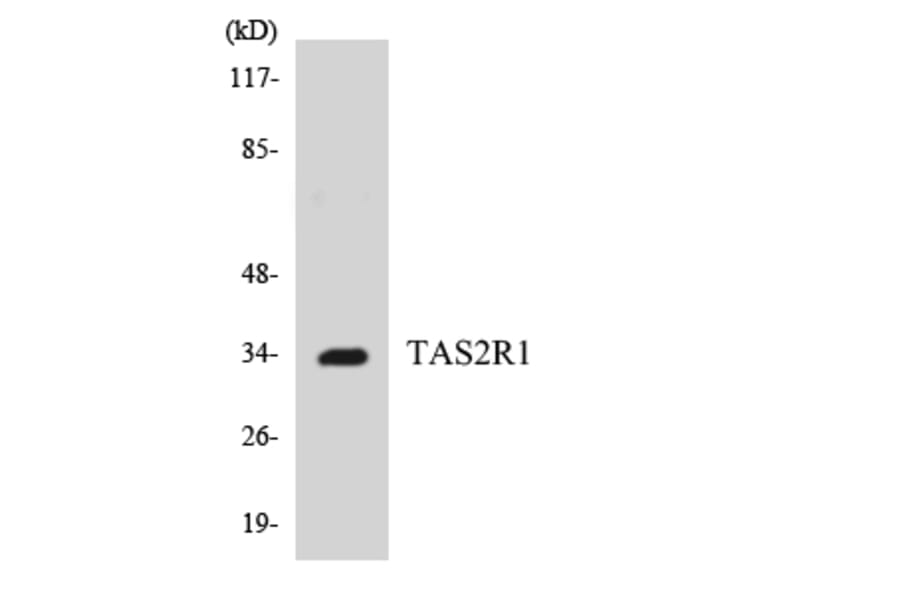 Western Blot - Anti-TAS2R1 Antibody (R12-3588) - Antibodies.com