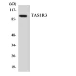 Western Blot - Anti-TAS1R3 Antibody (R12-3587) - Antibodies.com