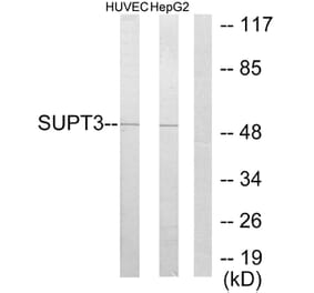 Western Blot - Anti-SUPT3H Antibody (C10182) - Antibodies.com
