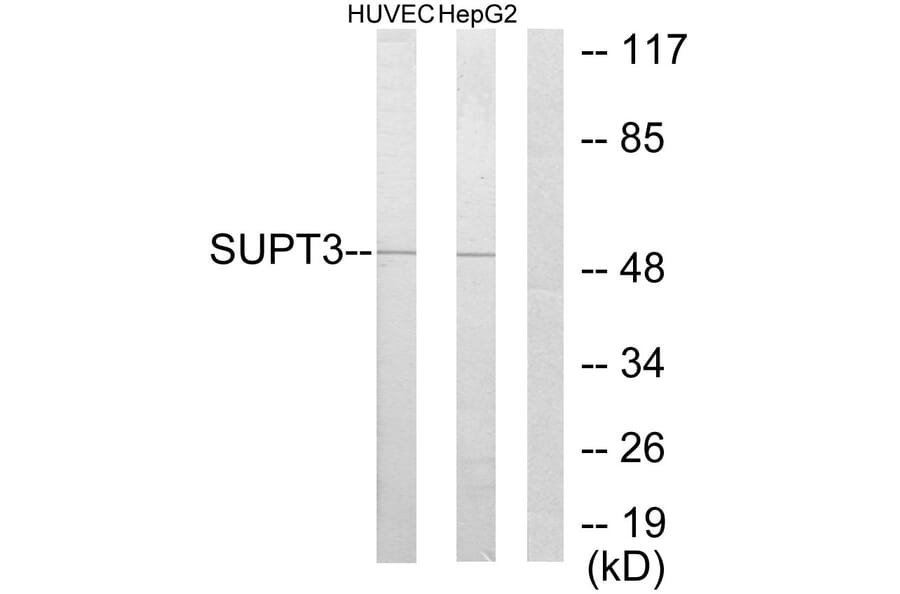 Western Blot - Anti-SUPT3H Antibody (C10182) - Antibodies.com