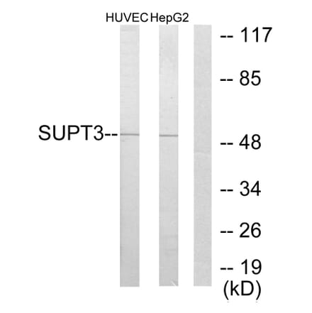 Western Blot - Anti-SUPT3H Antibody (C10182) - Antibodies.com