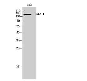 Western Blot - Anti-SPINK5 Antibody (C18523) - Antibodies.com