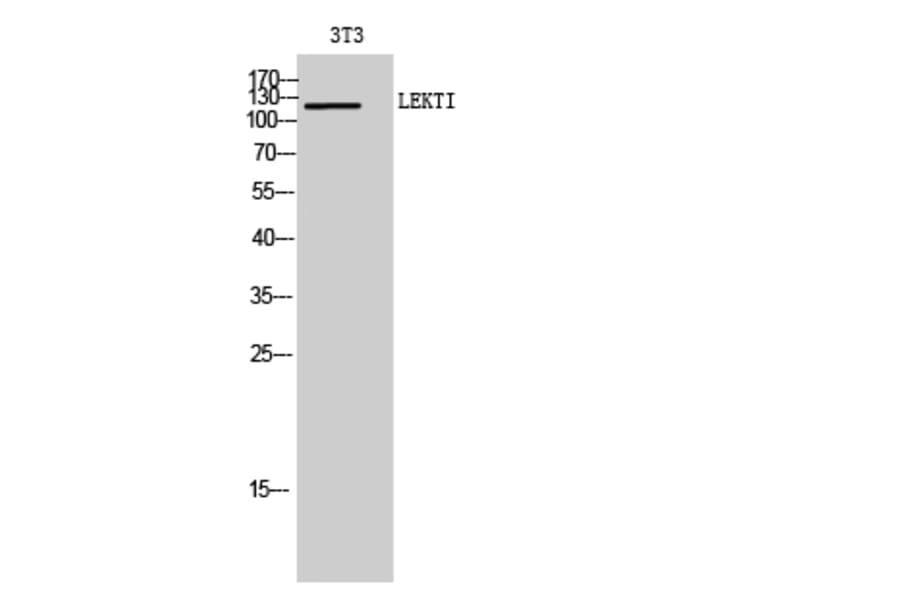Western Blot - Anti-SPINK5 Antibody (C18523) - Antibodies.com