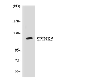 Western Blot - Anti-SPINK5 Antibody (R12-3556) - Antibodies.com