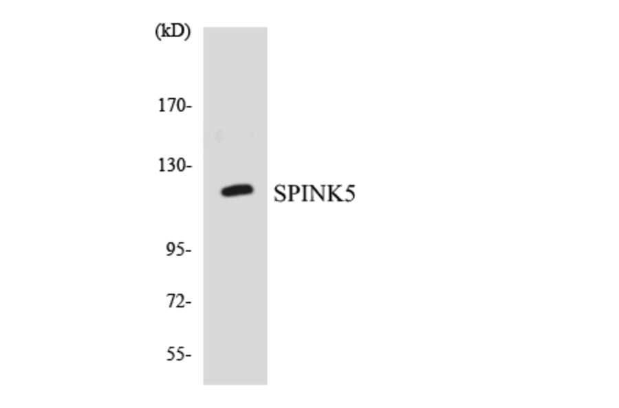 Western Blot - Anti-SPINK5 Antibody (R12-3556) - Antibodies.com