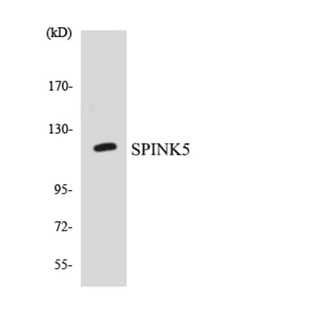 Western Blot - Anti-SPINK5 Antibody (R12-3556) - Antibodies.com