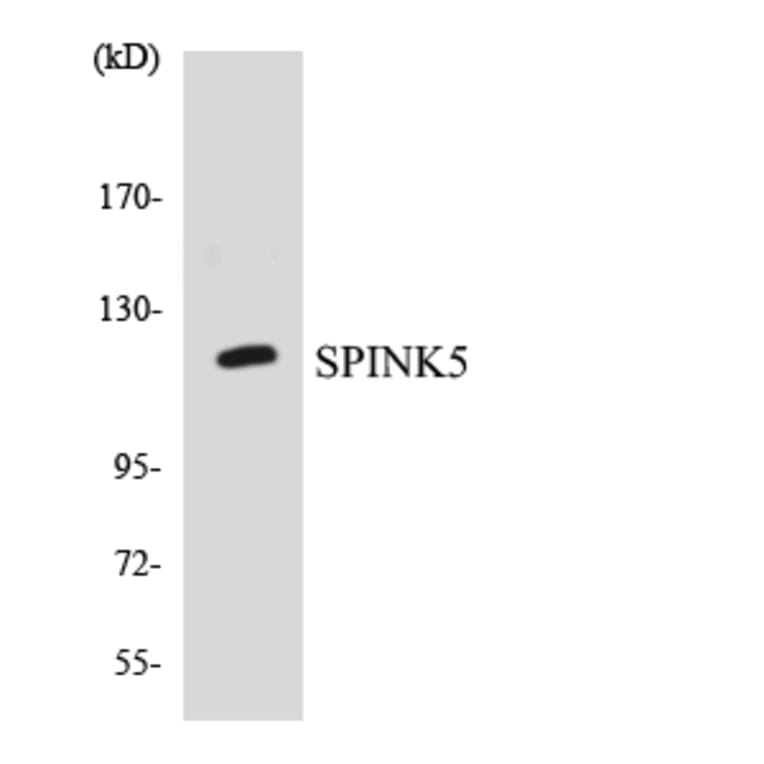 Western Blot - Anti-SPINK5 Antibody (R12-3556) - Antibodies.com