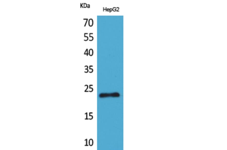 Western Blot - Anti-SNAP23 Antibody (C30294) - Antibodies.com