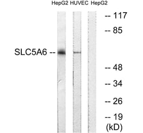 Western Blot - Anti-SLC5A6 Antibody (C18862) - Antibodies.com