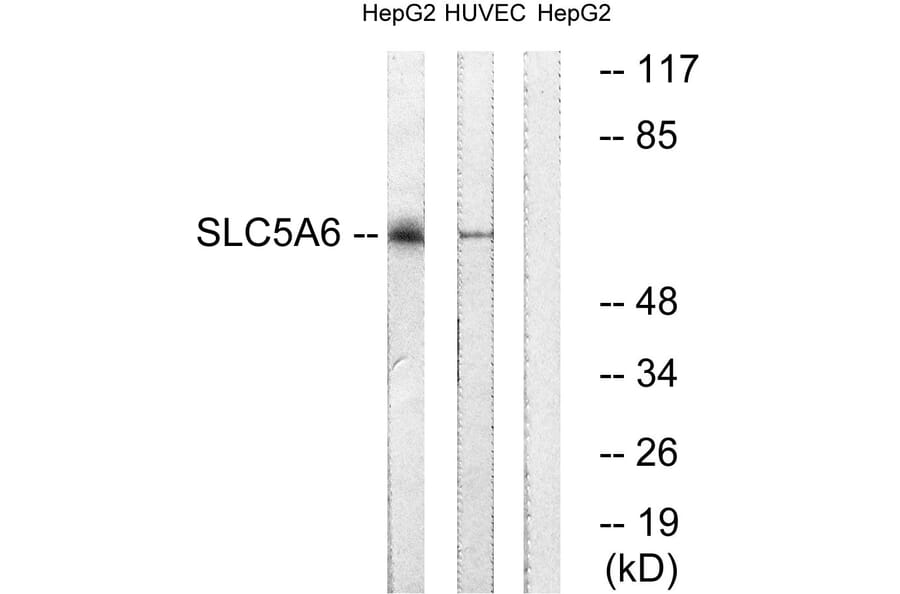 Western Blot - Anti-SLC5A6 Antibody (C18862) - Antibodies.com