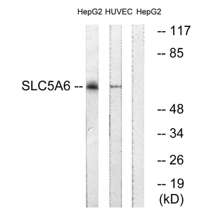 Western Blot - Anti-SLC5A6 Antibody (C18862) - Antibodies.com