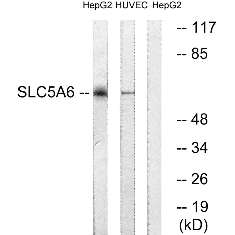 Western Blot - Anti-SLC5A6 Antibody (C18862) - Antibodies.com