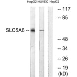 Western Blot - Anti-SLC5A6 Antibody (C18862) - Antibodies.com