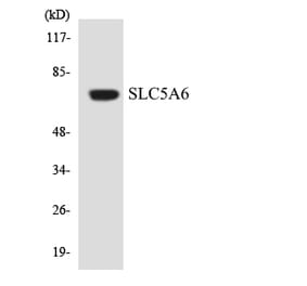 Western Blot - Anti-SLC5A6 Antibody (R12-3535) - Antibodies.com