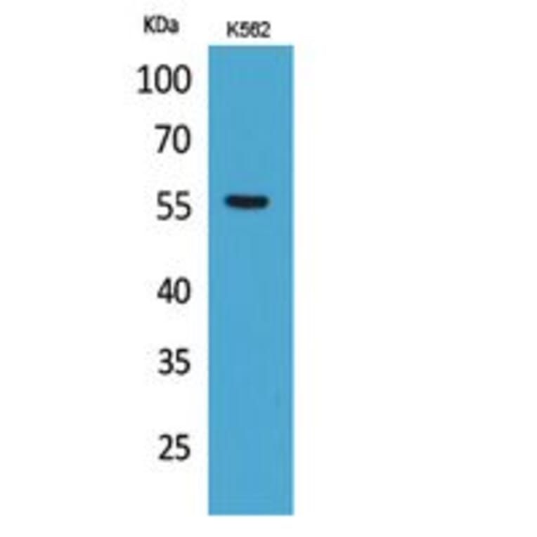 Western Blot - Anti-SLC2A5 Antibody (C30277) - Antibodies.com
