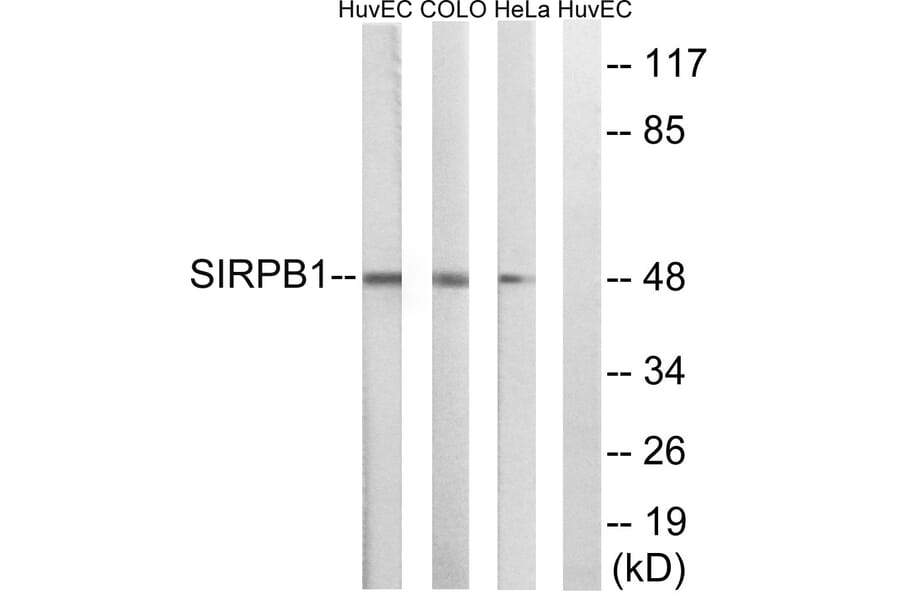 Western Blot - Anti-SIRPB1 Antibody (C18746) - Antibodies.com