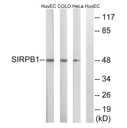 Western Blot - Anti-SIRPB1 Antibody (C18746) - Antibodies.com