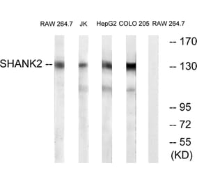 Western Blot - Anti-SHANK2 Antibody (C18711) - Antibodies.com