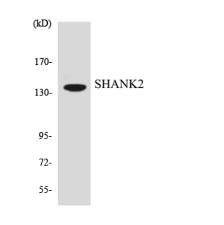 Western Blot - Anti-SHANK2 Antibody (R12-3504) - Antibodies.com