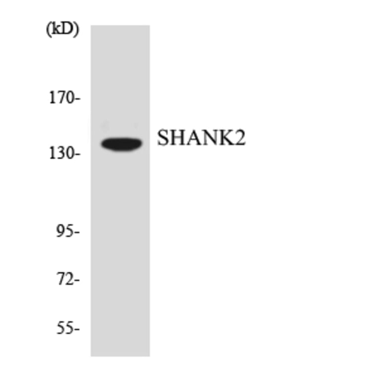 Western Blot - Anti-SHANK2 Antibody (R12-3504) - Antibodies.com