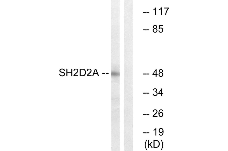 Western Blot - Anti-SH2D2A Antibody (C18699) - Antibodies.com