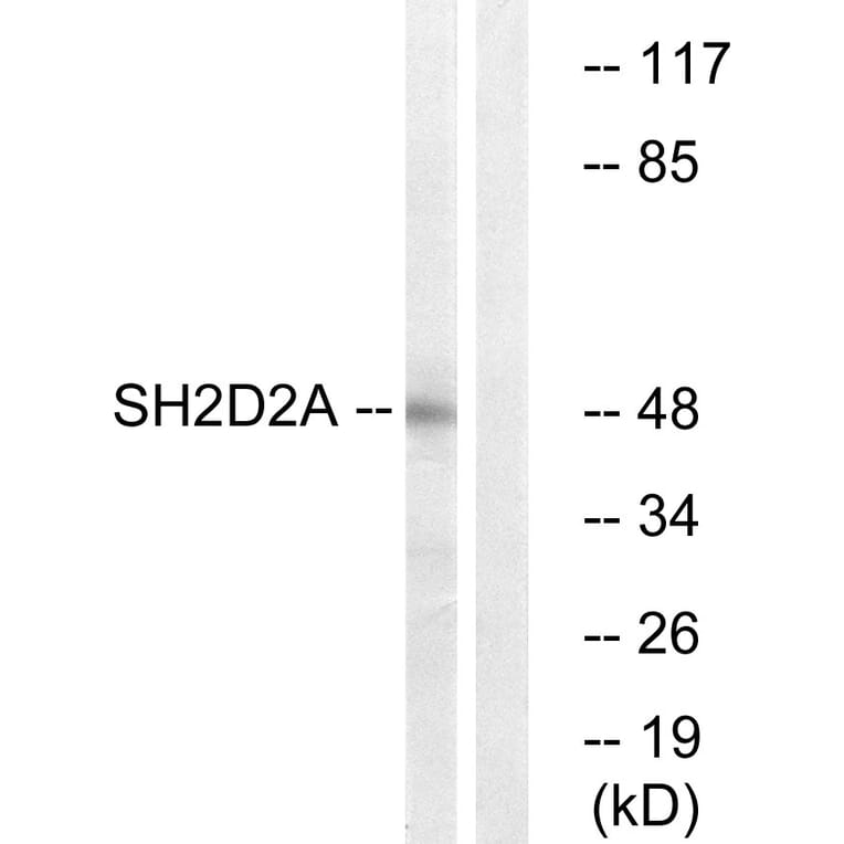 Western Blot - Anti-SH2D2A Antibody (C18699) - Antibodies.com