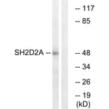 Western Blot - Anti-SH2D2A Antibody (C18699) - Antibodies.com