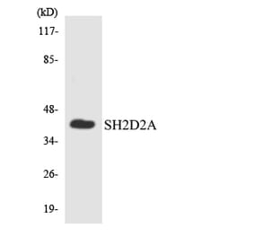 Western Blot - Anti-SH2D2A Antibody (R12-3502) - Antibodies.com
