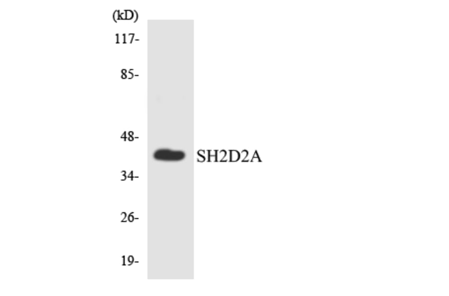 Western Blot - Anti-SH2D2A Antibody (R12-3502) - Antibodies.com
